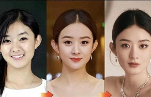 赵丽颖好不好看，不评价，但是吴佳妮说她没整容这事，肯定是真的